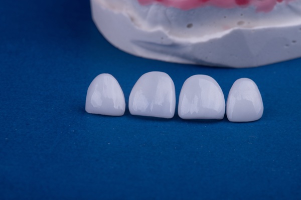 When Would A Prosthodontist Recommend Dental Crowns?