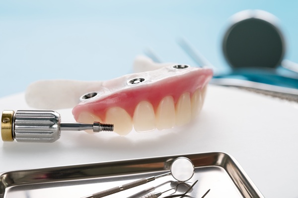 Understanding Implant Supported Dentures: A Comprehensive Guide