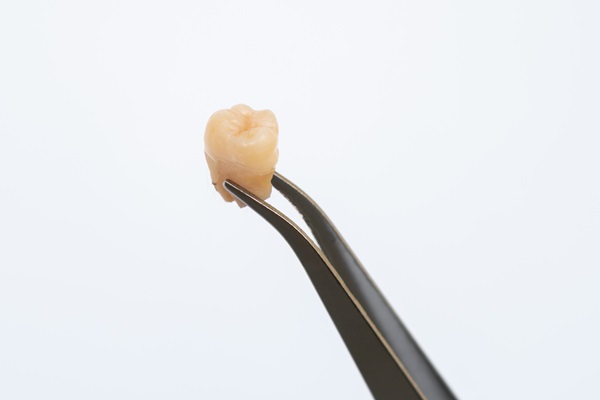 The Importance Of Getting Tooth Extractions From An Oral Surgeon